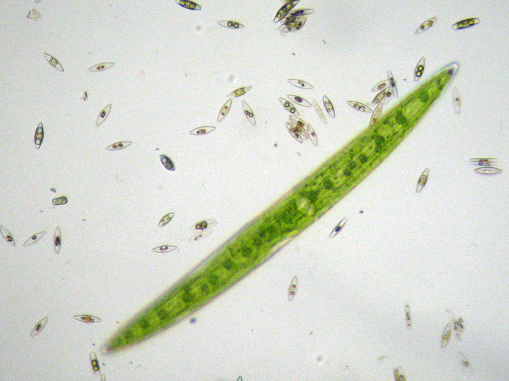 Forse Closterium acerosum
